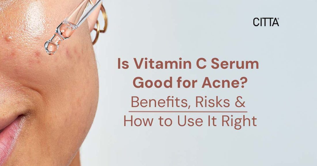 Is Vitamin C Serum Good for Acne? Benefits, Risks & How to Use It Right
