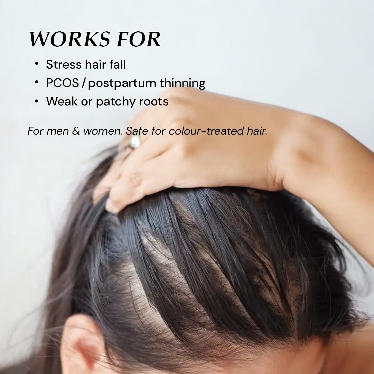 Hair growth serum for women and men – effective for stress-induced hair fall, PCOS, postpartum thinning and patchy roots