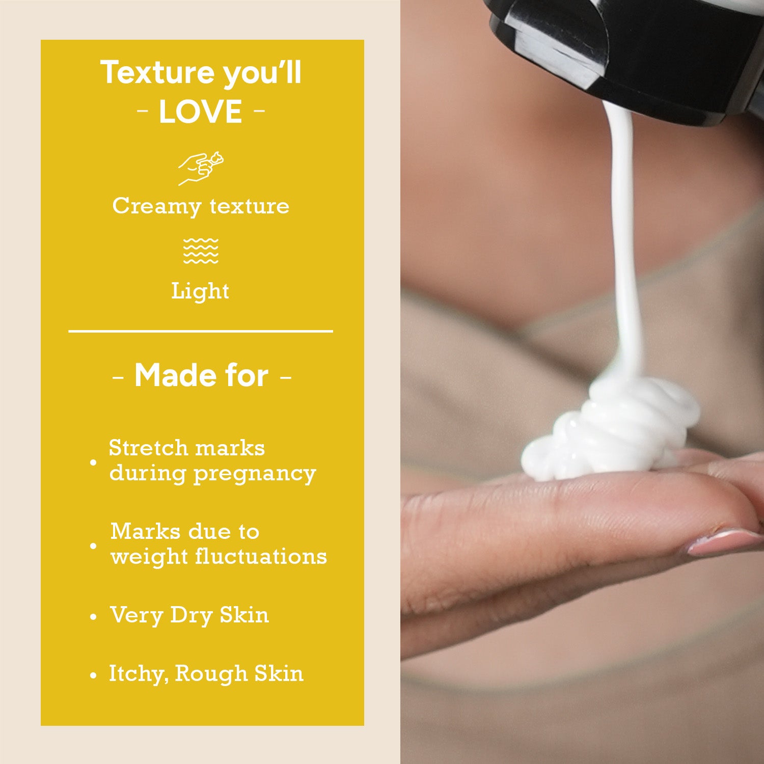 Light creamy texture stretch mark cream for pregnancy stretch marks, red stretch marks, weight fluctuation marks, and dry itchy skin