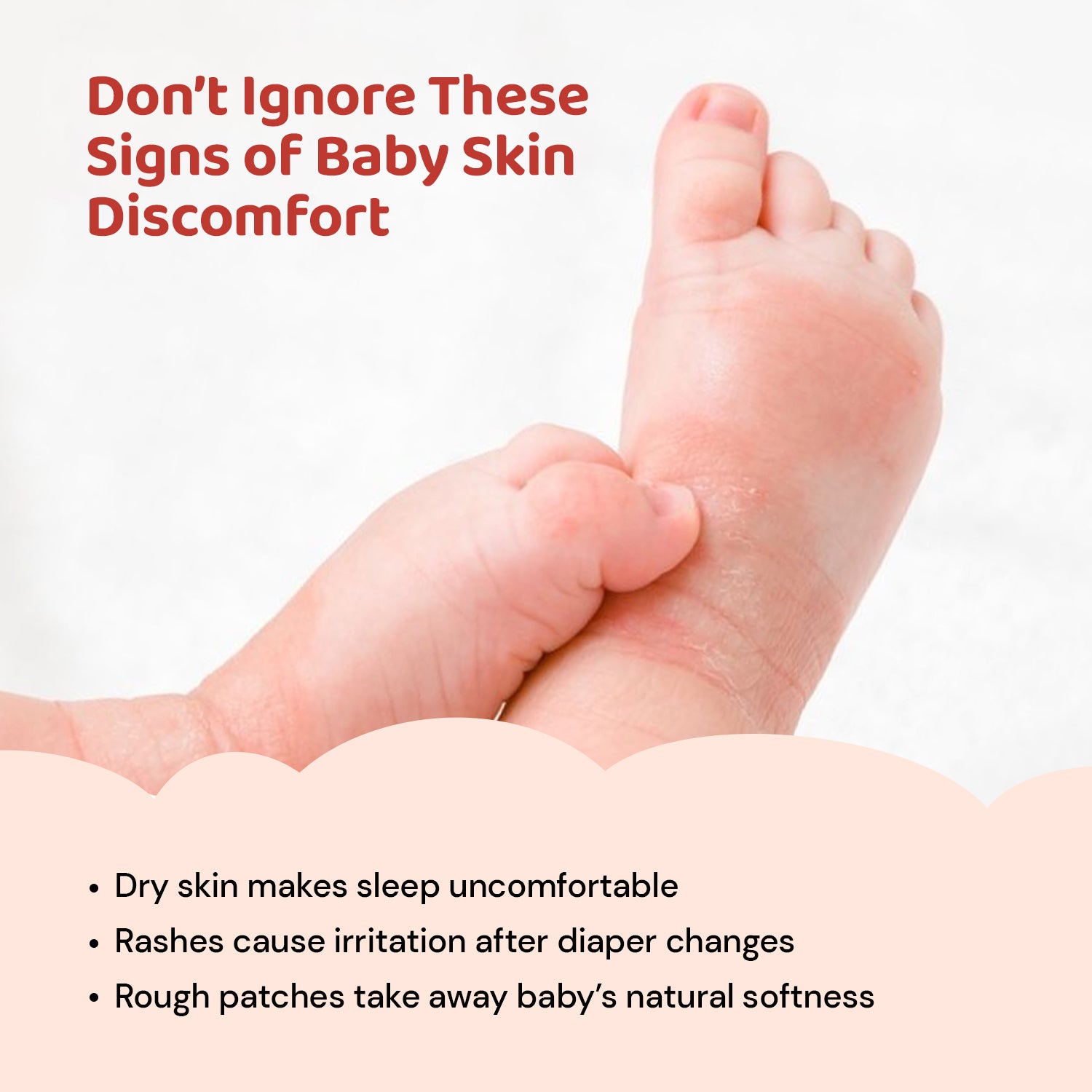Signs of Baby Skin Discomfort – Baby Balm and Moisturizer for Dry Skin & Rashes