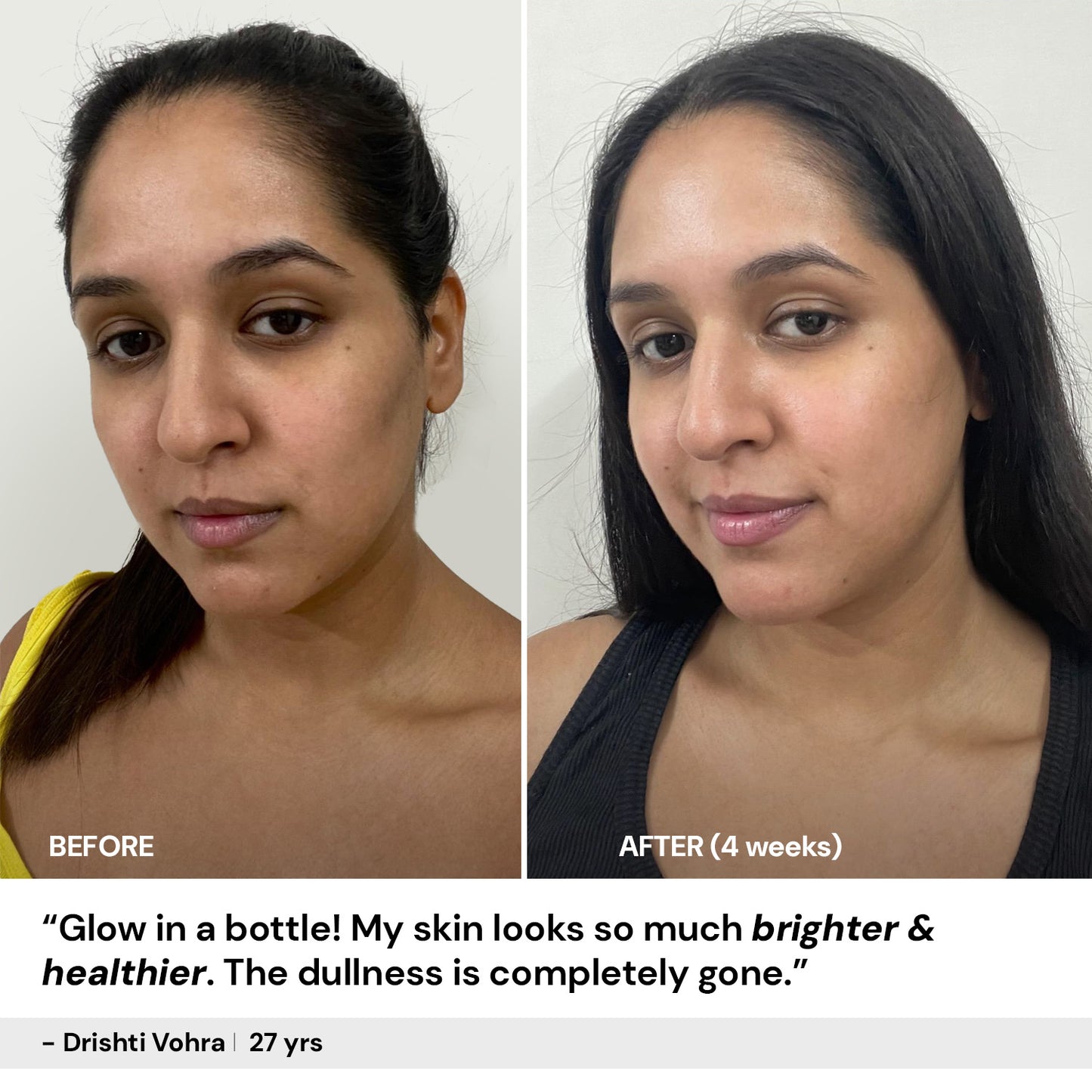 30ml $$** Vitamin C brightening face serum results after 4 weeks – visible glow and reduced dullness