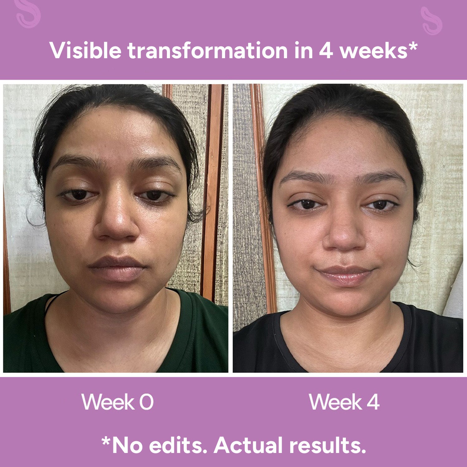 Before and after results with regenerative face serum showing reduced wrinkles and improved skin glow