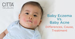 Baby Eczema Vs. Baby Acne: Differences | Cause | Treatment