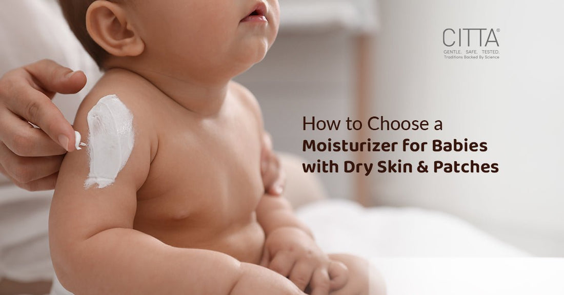 How to Choose a Moisturizer for Babies with Dry Skin and Patches