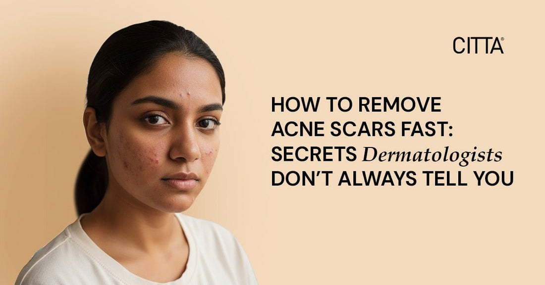 How to Remove Acne Scars Fast: Secrets Dermatologists Don’t Always Tell You