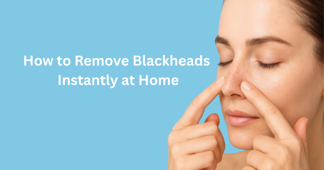 How to Remove Blackheads Instantly at Home