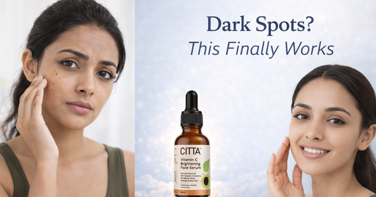 How to Remove Dark Spots on Face Permanently