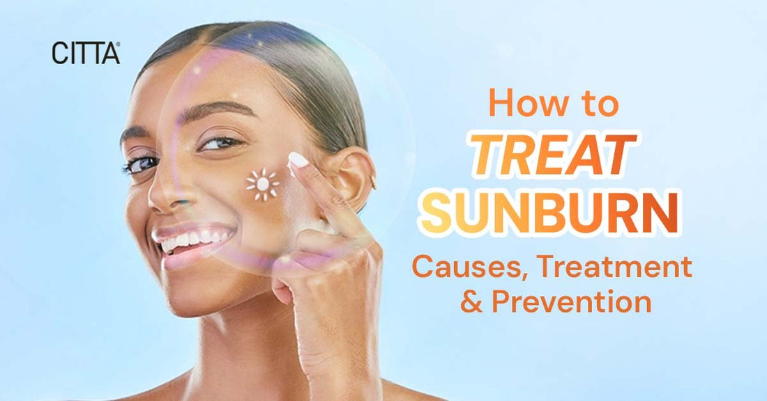 How to Treat Sunburn: Causes, Treatment & Prevention Tips