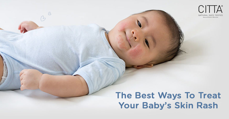 How to treat baby's skin rash