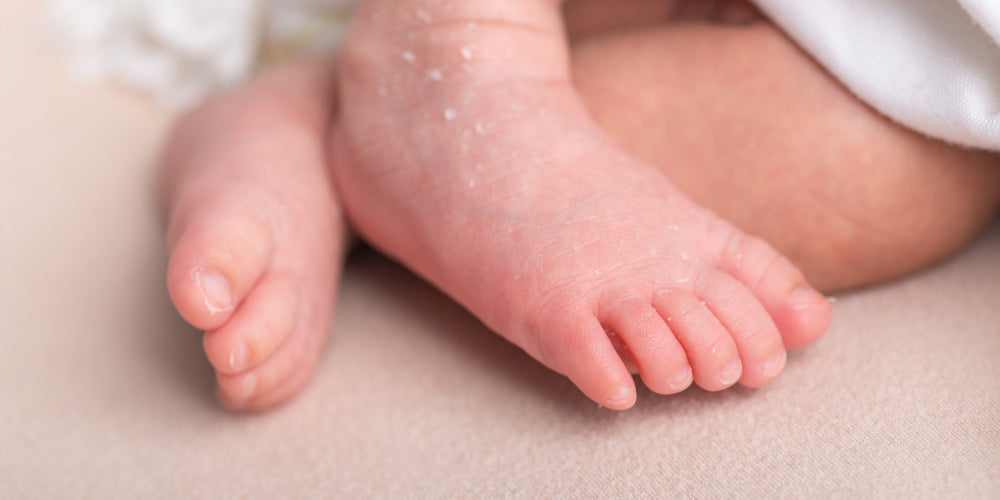 How to Treat and Prevent Common Skin Issues with the Right Baby Moisturizer