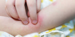 How Parents Can Find the Best Newborn Eczema Moisturizer to Soothe Skin Issue