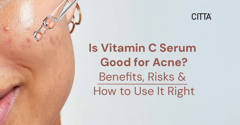 Is Vitamin C Serum Good for Acne? Benefits, Risks & How to Use It Right