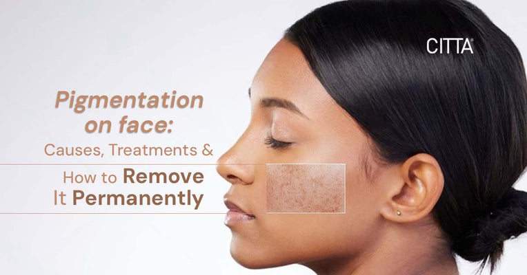 Pigmentation on Face: Causes, Treatments &; How to Remove It Permanently