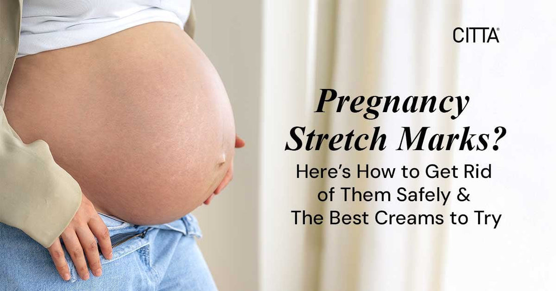 Pregnancy Stretch Marks? Here’s How to Get Rid of Them Safely &amp; The Best Creams to Try