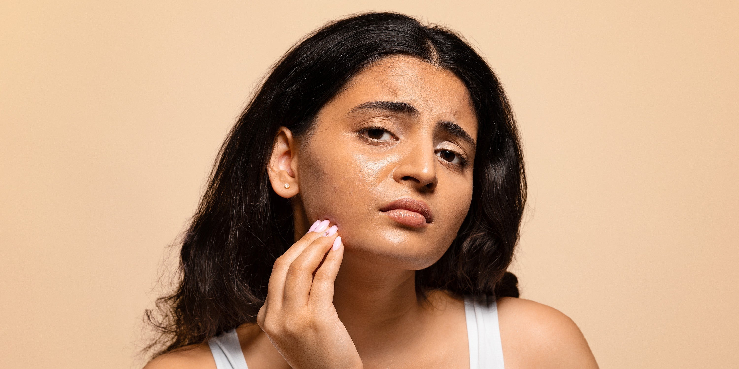 Know Your Skin Type: Why It Matters & How to Identify It