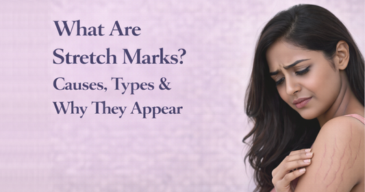 What Are Stretch Marks? Causes, Types & Why They Appear