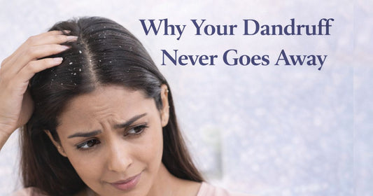 How To Get Rid Of Dandruff Permanently: Why Most Remedies Fail & What Actually Works