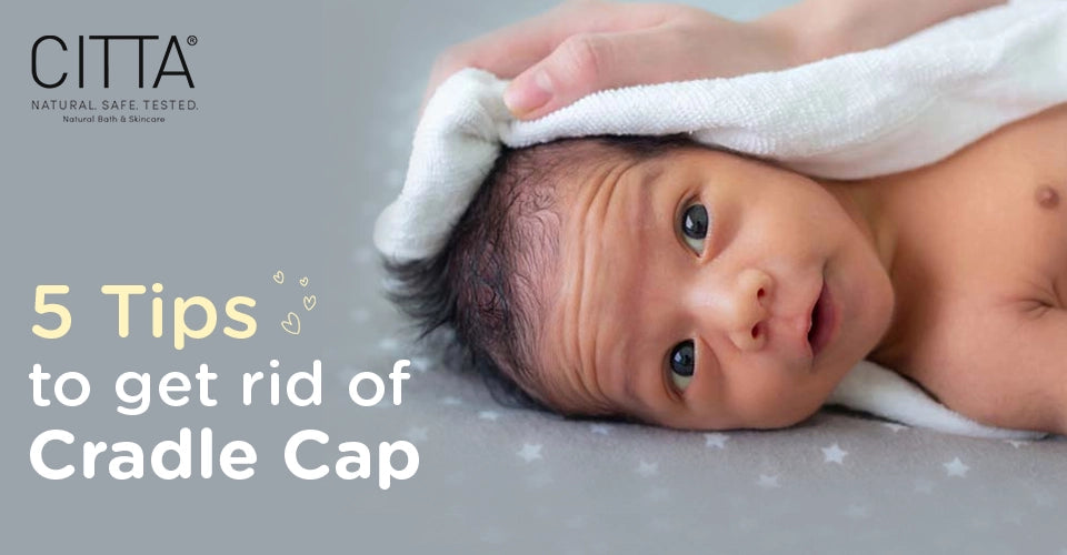 5 tips to treat cradle cap