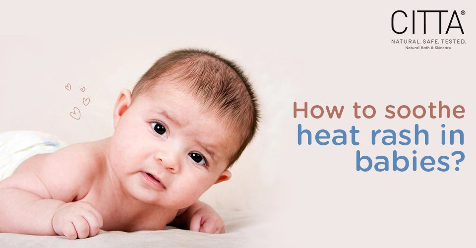 How to treat baby heat rashes