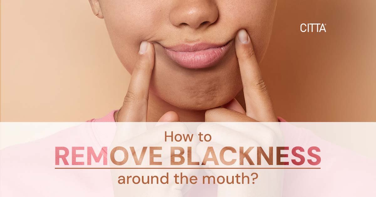 Hyperpigmentation Around Mouth: Causes, Treatments & Prevention