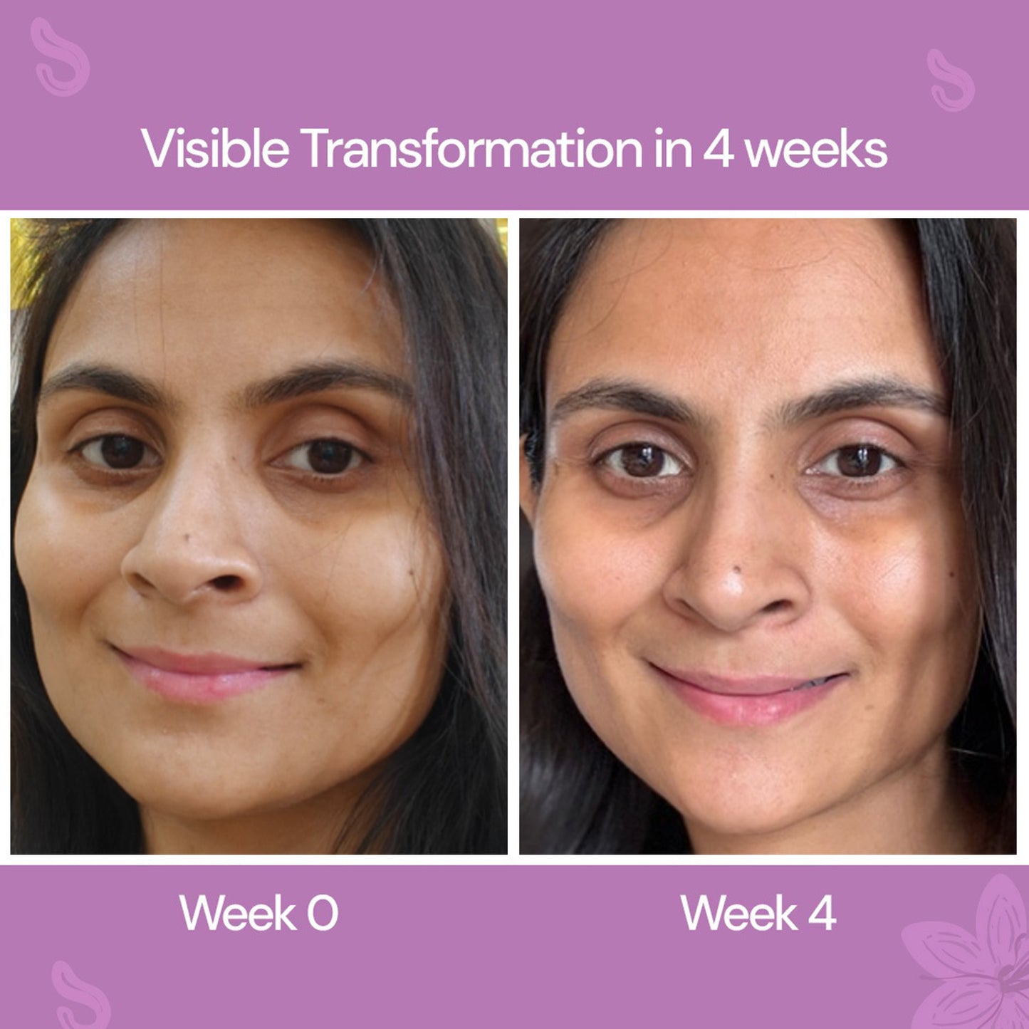 50gm $$**  CITTA Anti-Aging Night Cream visible transformation in 4 Weeks
