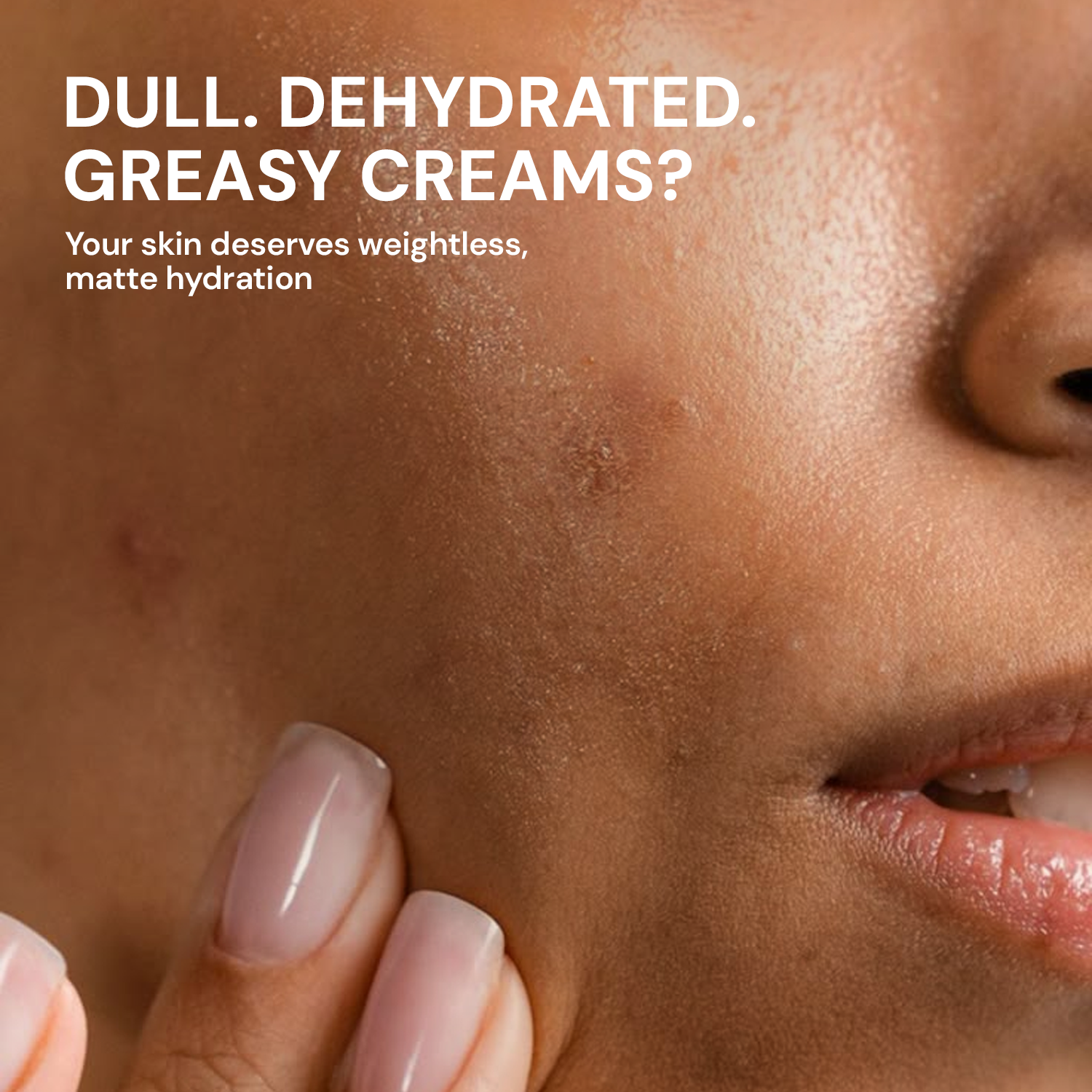 Aqua Boost Face Gel | Lightweight Moisturizer with Hyaluronic Acid, Oil-Free & Non-Comedogenic for Oily Skin