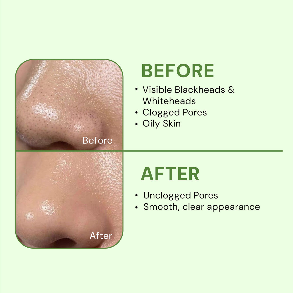 CITTA Bye Bye Blackheads Charcoal Nose Strip