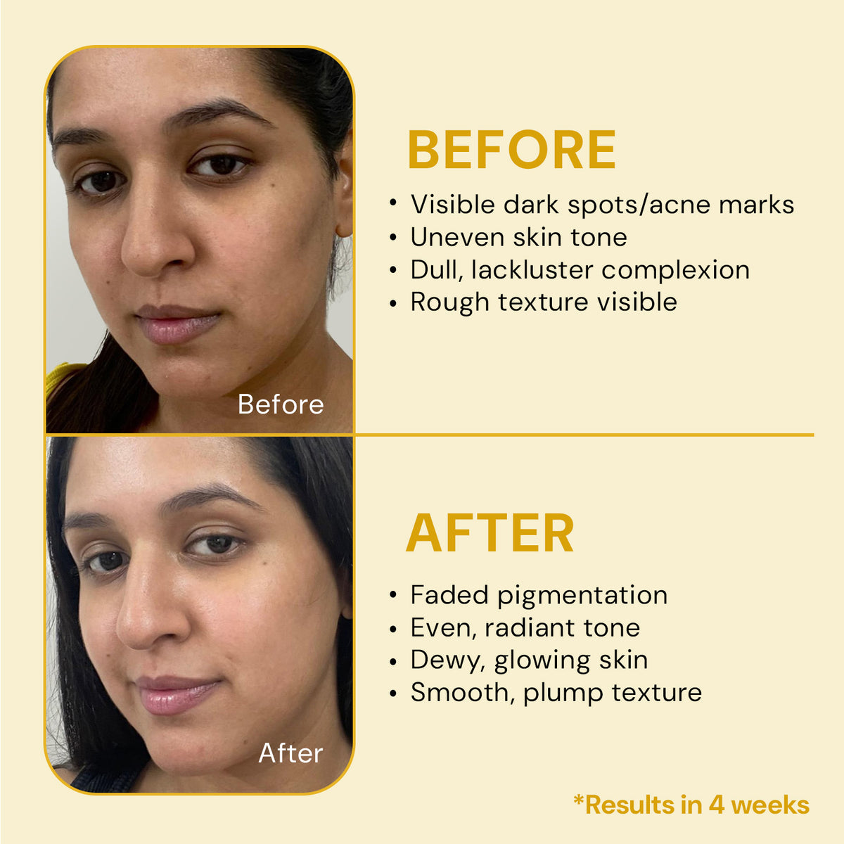 12% Vitamin C Serum | With Hyaluronic Acid for Brightening & Pigmentation