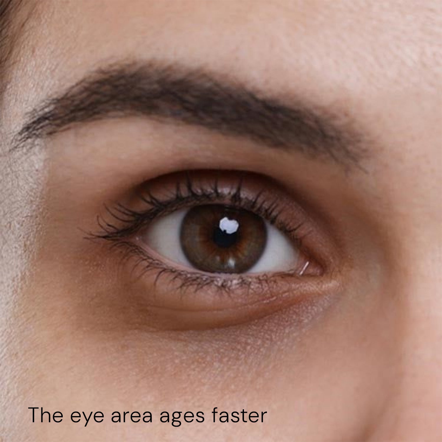Eye area showing signs of aging with fine lines and dryness