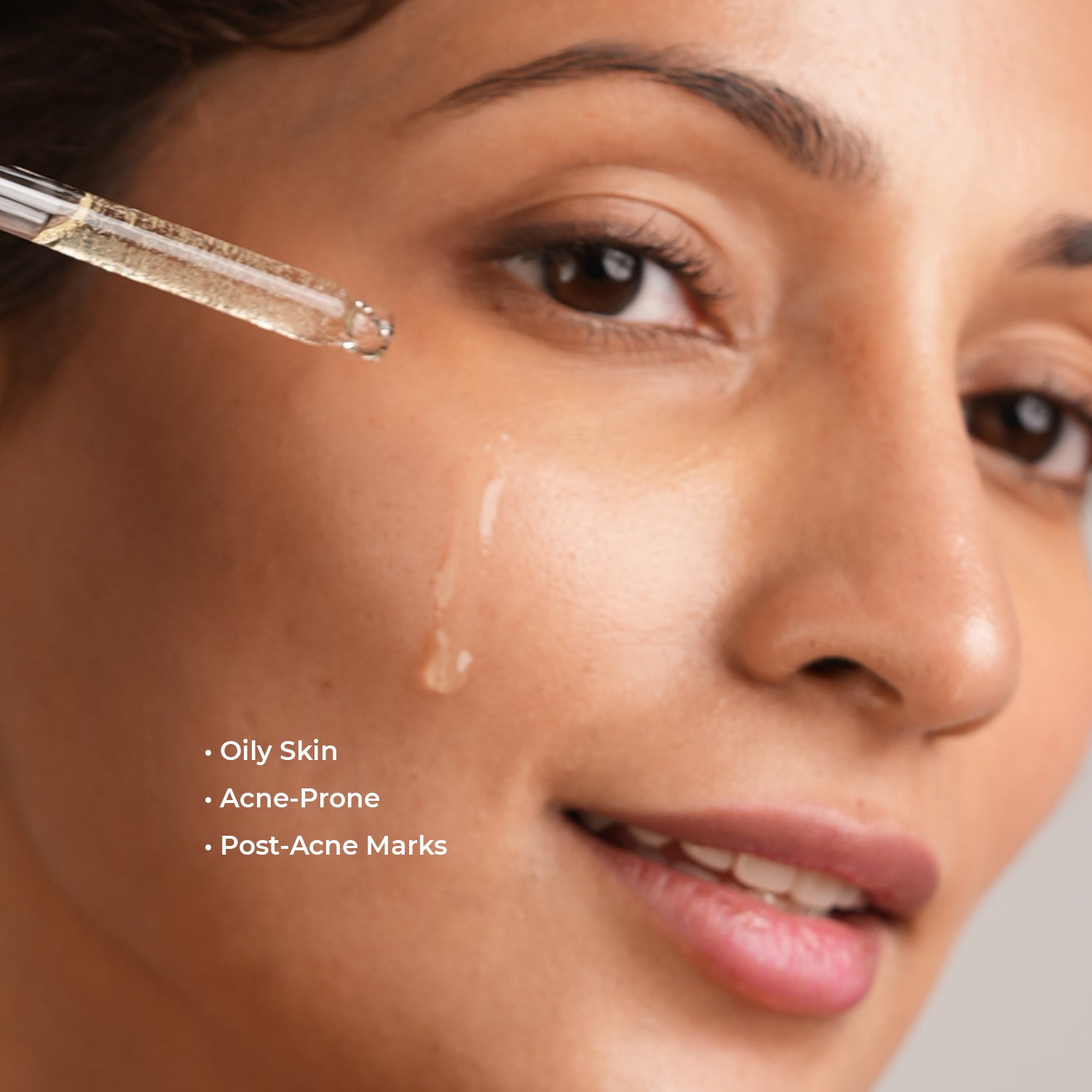 Acne Evolution Multi-Action Serum