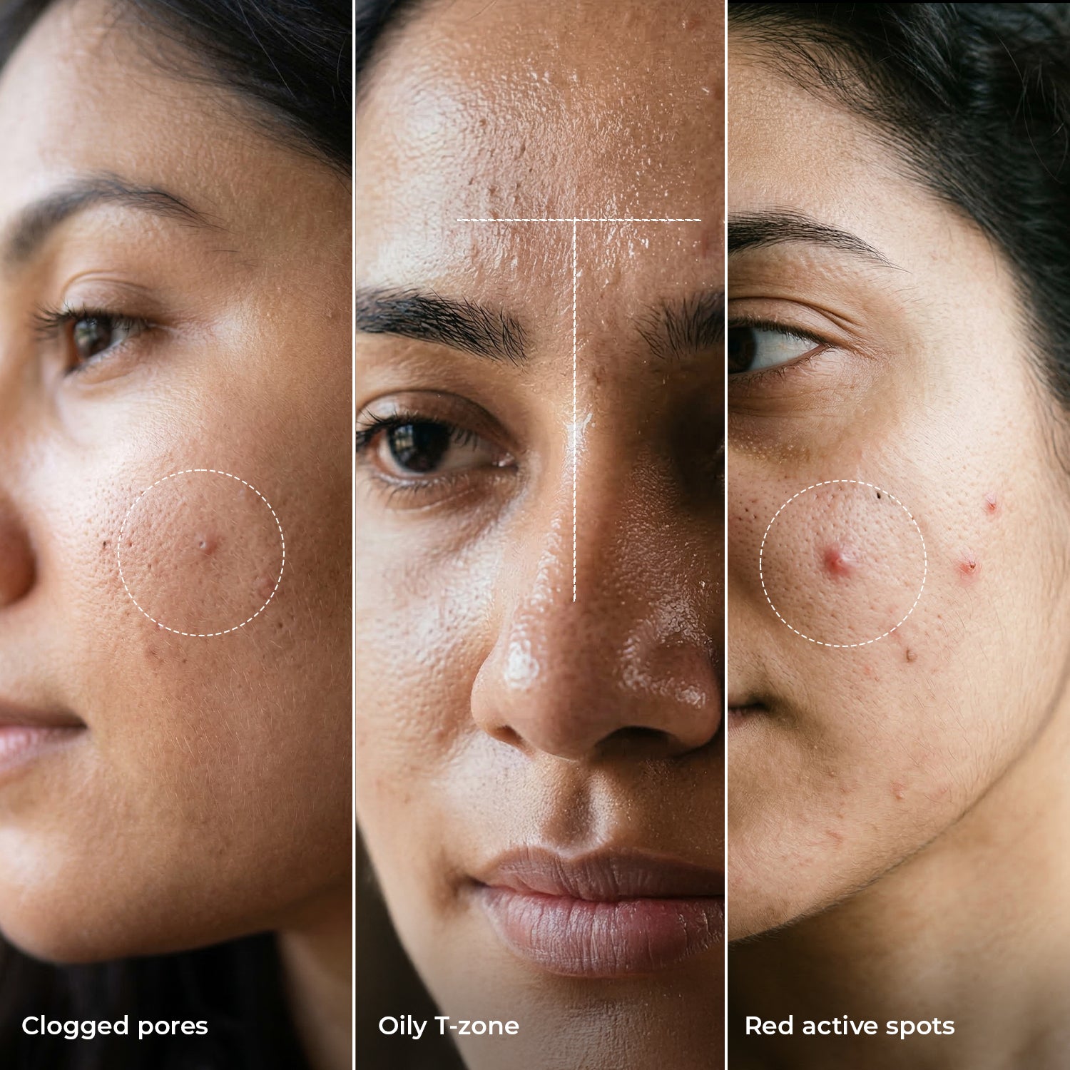 Acne Evolution Barrier Face Wash